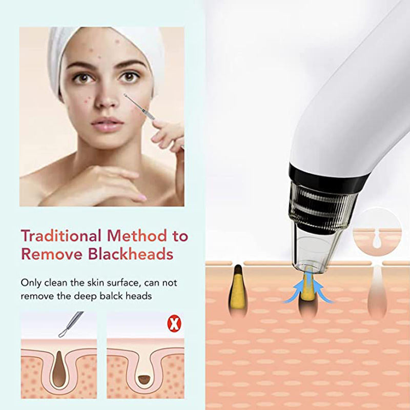 2026 Blackhead Remover Vacuum – USB Rechargeable Pore Cleaner with 5 Suction Levels & 5 Probes